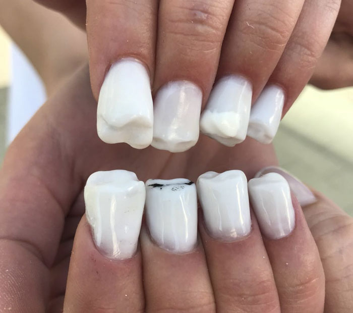 Teeth-Nails Exist, And If You Think They Can't Get Any Worse, Watch This Video