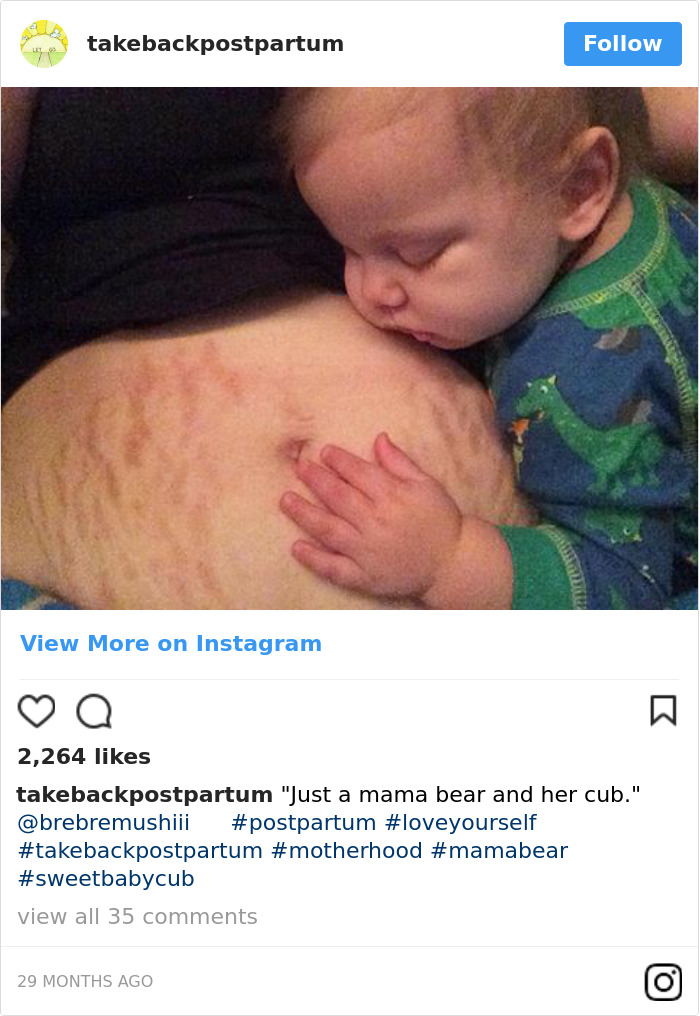 50+ Brutally Honest Photos Of Post-Baby Bodies, That Women ...