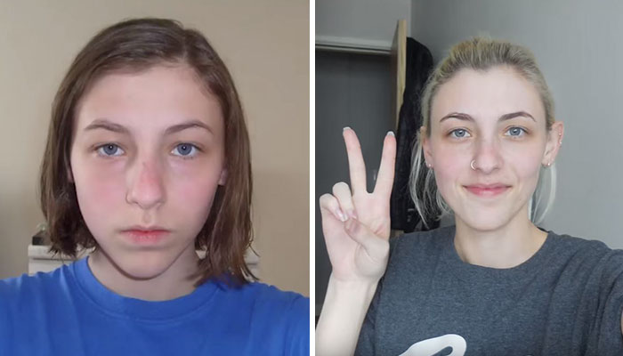 Teen Takes Selfies Every Day For 8 Years, Shows How Subtle Changes Create A Big Difference At The End