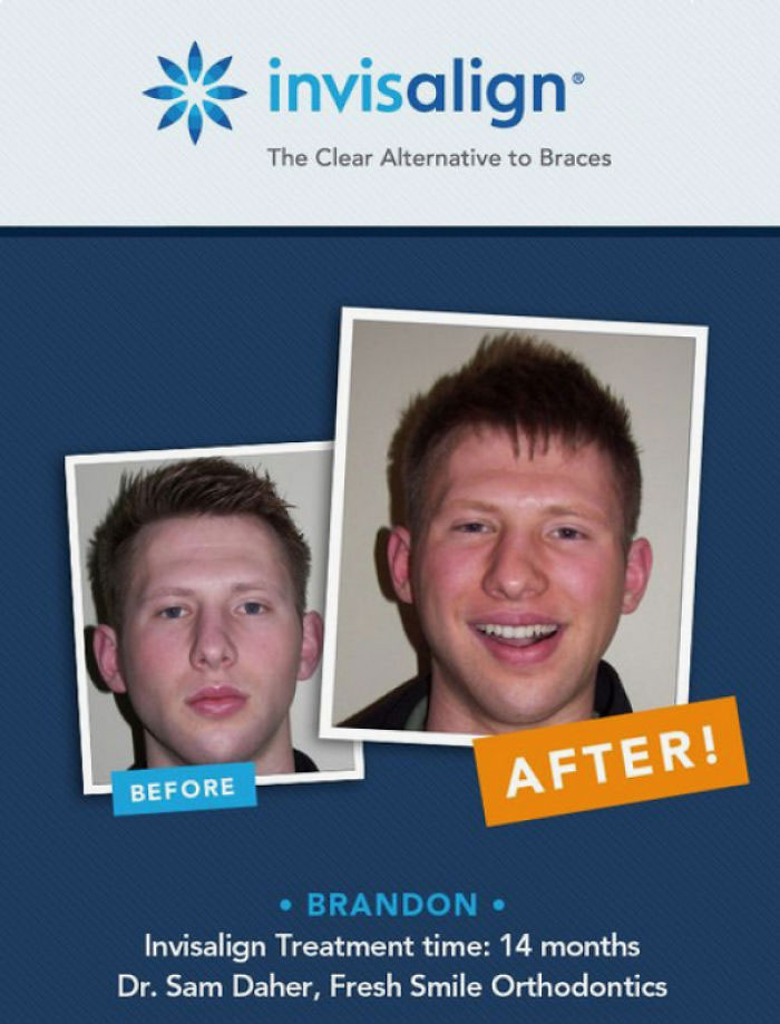 This Ad For Dental Care That Fails To Show The Teeth In The Before Picture
