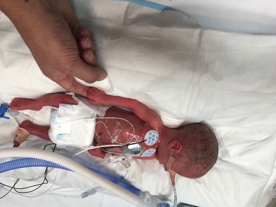 These Parents Had A Surprise Addition To Their Family (Pics & Video) These Parents Had A Surprise Addition To Their Family (Pics & Video)