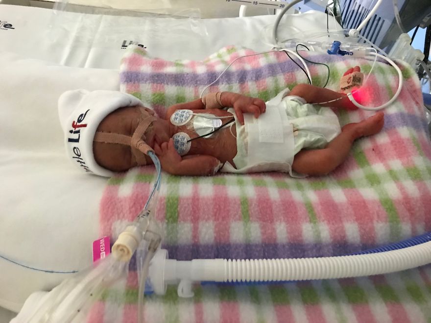 These Parents Had A Surprise Addition To Their Family (Pics & Video) These Parents Had A Surprise Addition To Their Family (Pics & Video)