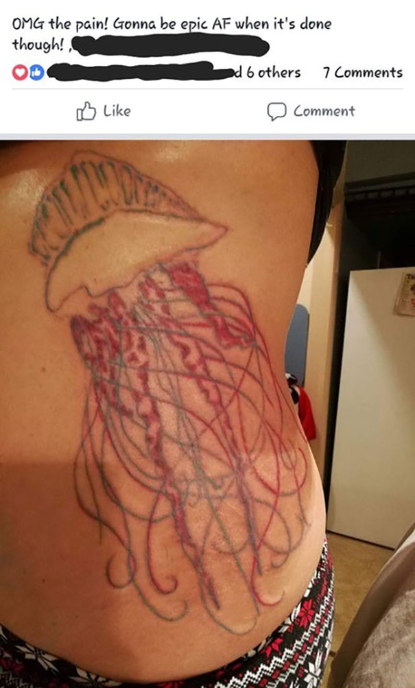 Badly executed large jelly fish tattoo