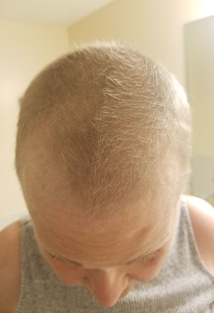 My Mom Won Her Battle With Cancer Back In May And Loves To Greet Me By Showing Me How Much Her Hair Has Grown Since Last I Saw Her. Today, She Was So Excited To Show Me The World's Tiniest Fauxhawk