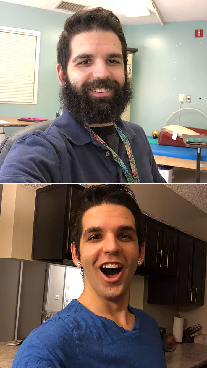 I Work With Patients In Rehab. 2 Months Ago I Made A Bet With A Patient I Would Shave If We Could Get Him To Reach A Certain Goal. Today, He Did It. Tomorrow He Gets Baby Me