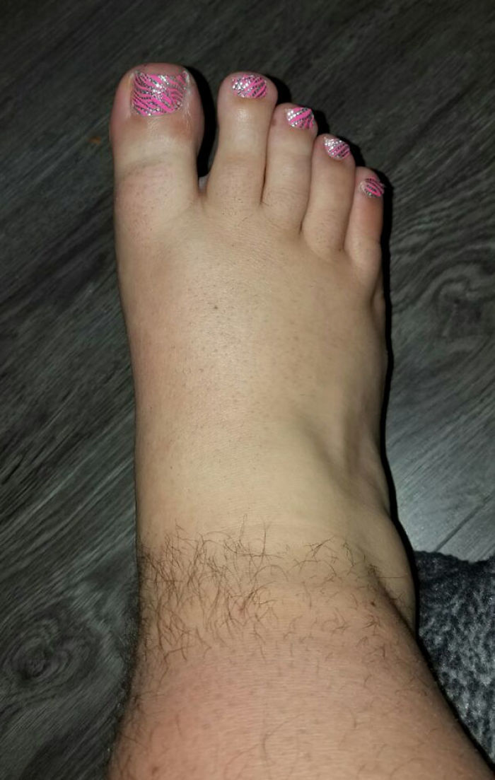 Mi marido apostó a que no podía afeitarle un pie sin despertarle. Esta mañana amaneció así