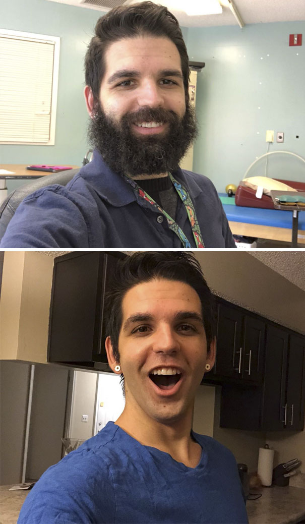I Work With Patients In Rehab. 2 Months Ago I Made A Bet With A Patient I Would Shave If We Could Get Him To Reach A Certain Goal. Today, He Did It. Tomorrow He Gets Baby Me