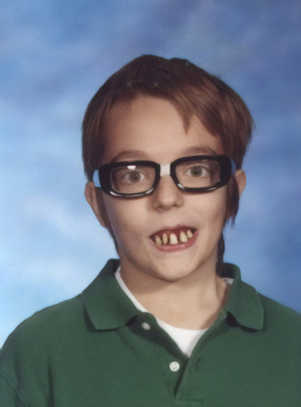 I Wore Fake Glasses And Fake Teeth For My 6th Grade Yearbook Photo To Prank My Mom
