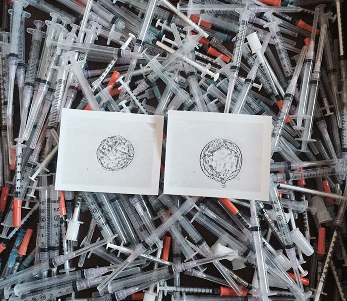 Viral Photo Shows Newborn Baby Surrounded By The 1616 Injection Needles It Took To Make It
