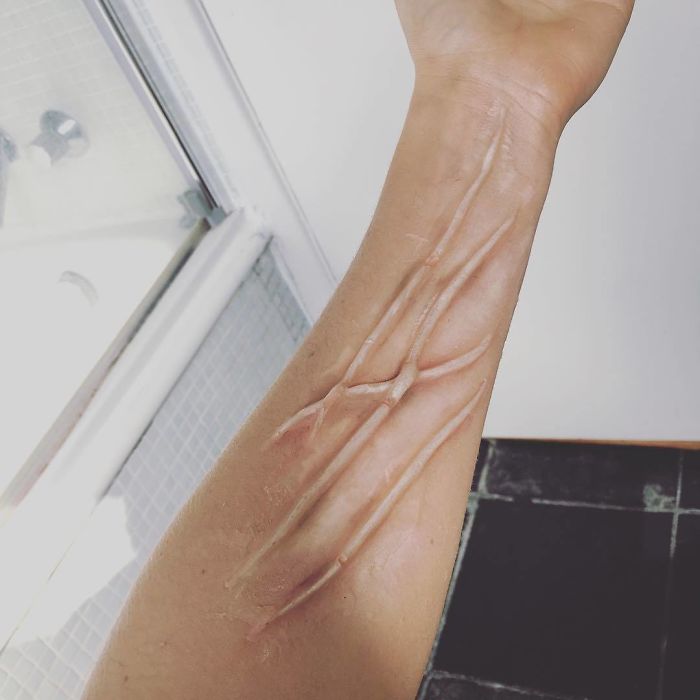 Celebrities Are Getting Temporary Skin "Implants" And It's Freaking People Out