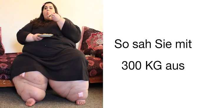 300 kg frau nackt