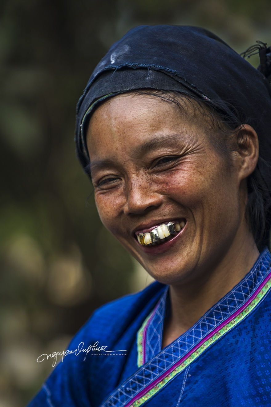 The Golden Teeth Of The Ethnic Minorities Of Vietnam