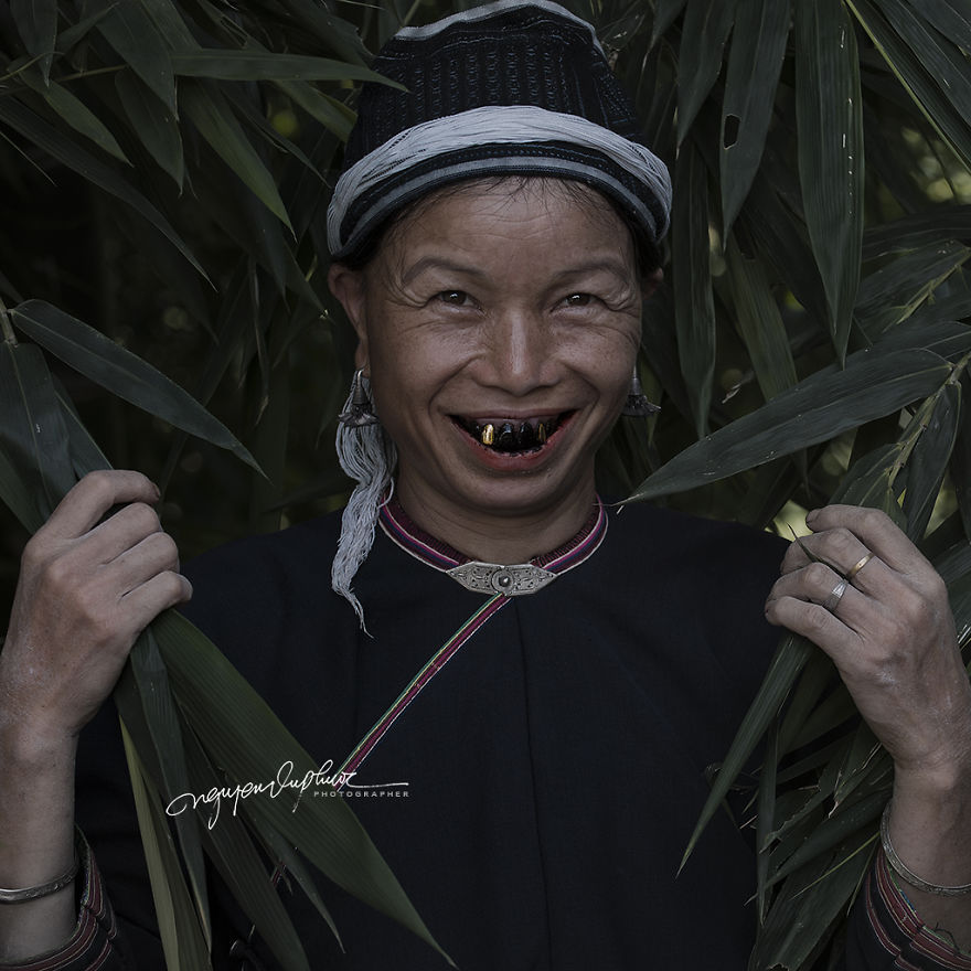 The Golden Teeth Of The Ethnic Minorities Of Vietnam