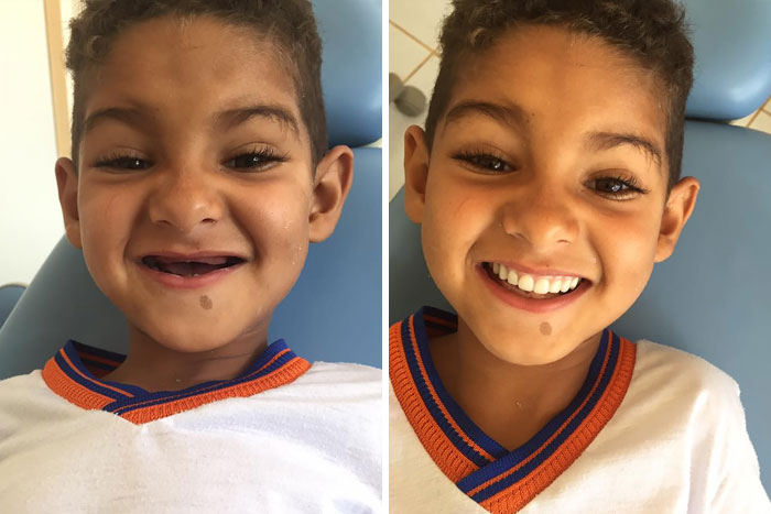 Un dentista cumplió el sueño de este niño al darle una sonrisa "como las de sus compañeros de clase"