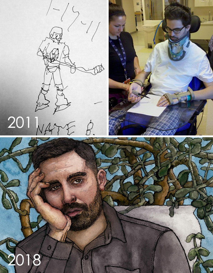 I Broke My Neck And Was Paralyzed In December, 2010. Here Is A Photo Of The First Drawing I Did In Rehab, With Assistance From My Recreational Therapist Ashley. Followed By A Self Portrait I Did 7 Years Later. I’ve Improved A Little