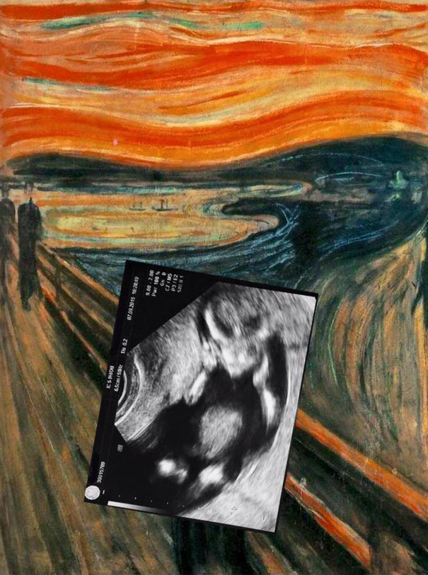 My Colleague Uploaded The First Photo Of His Unborn Child