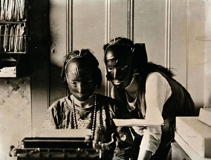 Rubber Beauty Masks Used To Get Rid Of Wrinkles In The 1920s