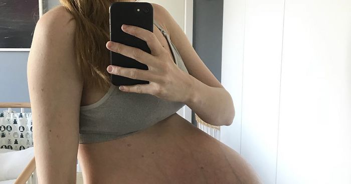 Here’s What Being Pregnant With Triplets Does To Your Body