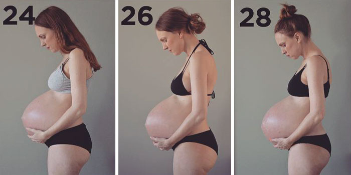 Here's What Being Pregnant With Triplets Does To Your Body