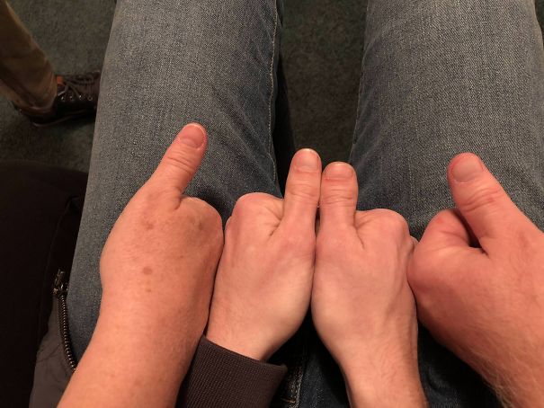 My Brother-In-Law Got A Thumb From Each Parent