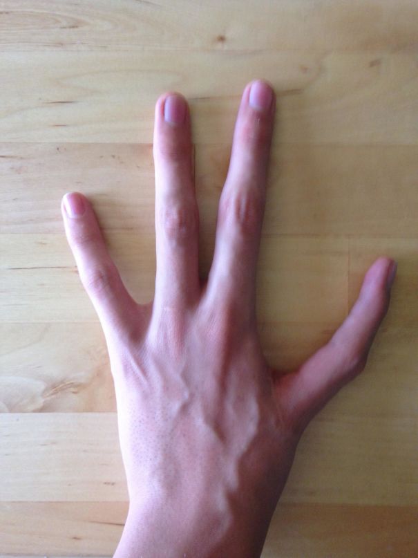 I Have Only Four Fingers On My Left Hand, And Have And Index Finger Instead Of My Thumb