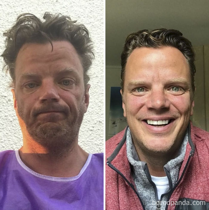 I Took The Picture On The Left Almost 17 Months Ago, Outside An Emergency Room, At Sunrise, Something Told Me I Didn’t Want To Forget That Moment. I Forget Easily. I’m Going Public With This Now Simply Because I Need To Advocate For Recovery More