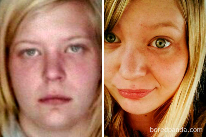 20 Before amp After Pics That Show What Happens When You Stop Drinking Asset Pharmacy