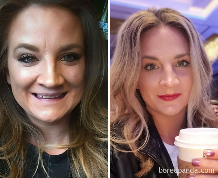 On The Left: 1-4 Bottles Of Wine A Week... Dayum, There's A Lot Of Full Coverage Foundation On That Mug. Eeeek. On The Right, 9 Months Later: Lots Of Infused Water, Bb Cream & Some Contour/Blush. The Difference: Sobriety