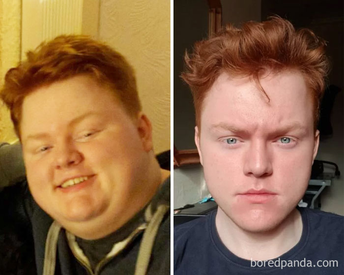 Lost 106 Lbs In 3 Years, Still Can't Do My Hair