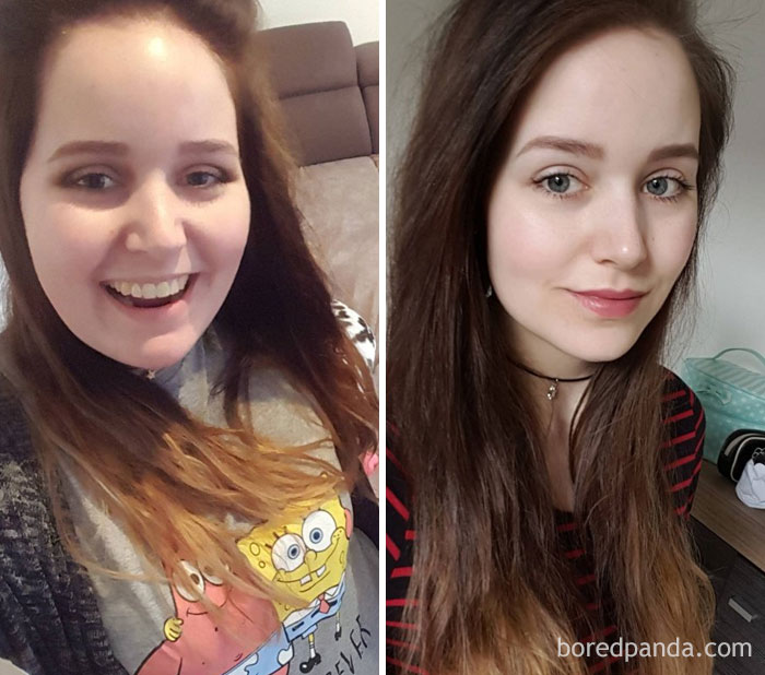 Weight Loss - 60 Lbs Face Gains