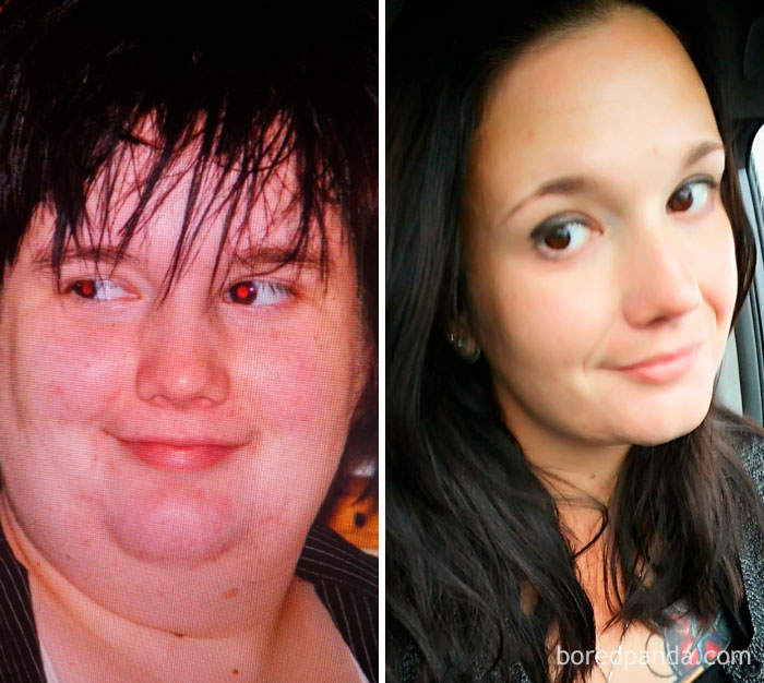 Face Progress. About 8 Years. CICO, Maturity And A Better Perspective On Life Got Me Here