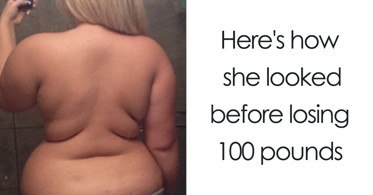 20+ Times People Surprised Everyone By Losing So Much Weight They Looked Like A Different Person