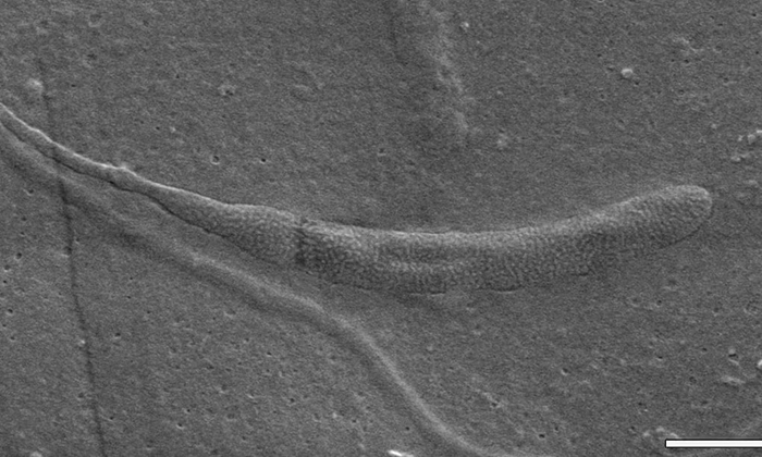 The World's Oldest Sperm Was Found In Antarctica
