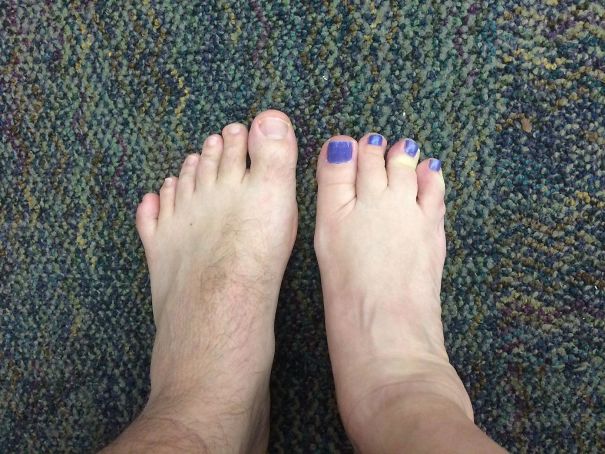 I Was Born With 6 Toes On My Left Foot And My Co-Worker Was Born With 4 Toes On Her Right Foot