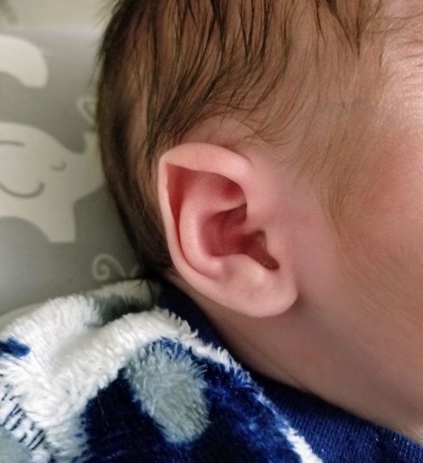 My Son Was Born With Natural Elf Ears