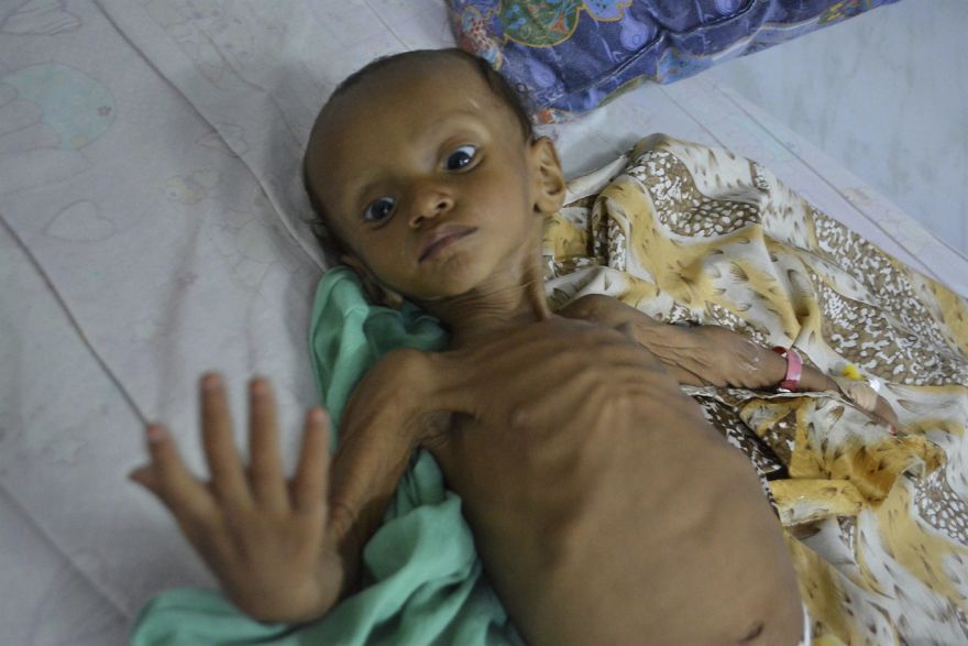 Please Help With The Biggest Humanitarian Crisis Happening In Yemen
