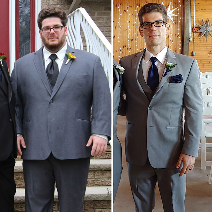 After Neglecting My Body For 10 Years, I Started Making Small Changes And Went From 300lbs To 150lbs