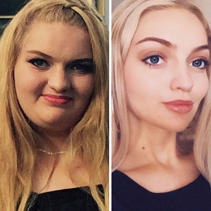 Overweight Teenager Surprises Everyone By Losing 139 Lbs To Fit Into Her Formal Dress