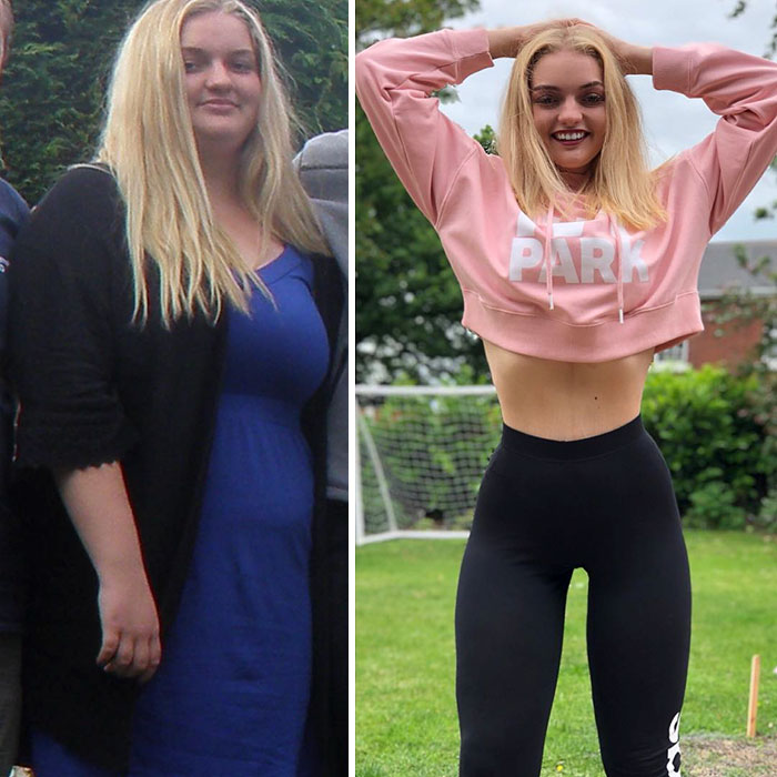 Overweight Teenager Surprises Everyone By Losing 139 Lbs To Fit Into Her Formal Dress