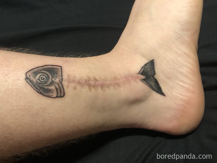 Scar-Birthmark-Tattoo-Cover-Ups