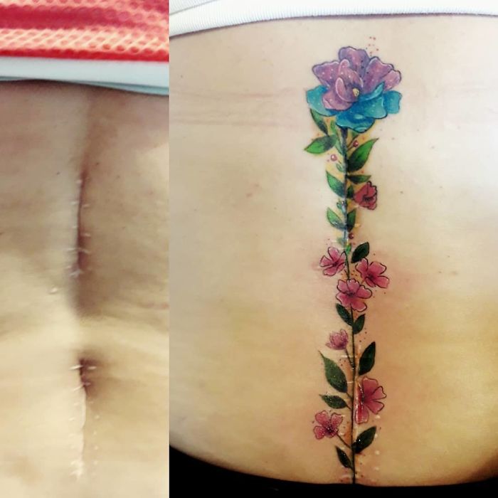 50 Times People Asked To Cover Up Their Scars And Birthmarks, And Tattoo Artists Nailed It