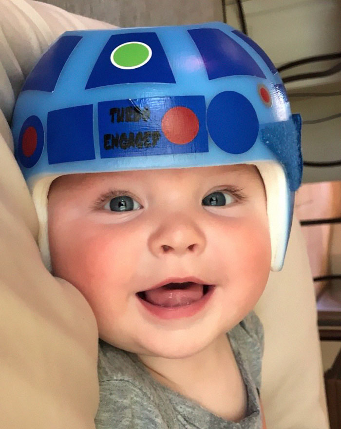 My Son Had A Helmet! It Went By So Quick And His Head Is Gorgeous Now!