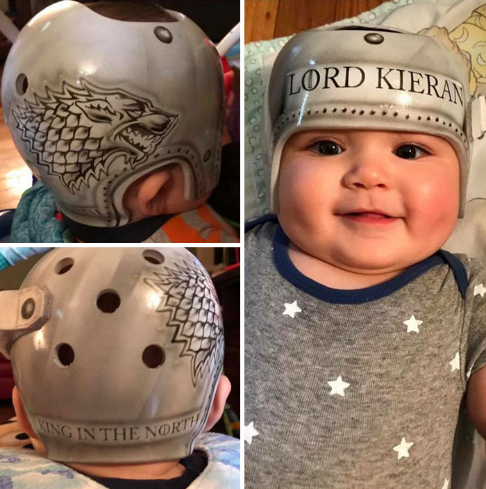 My Baby Wore A Helmet. He’s 2 Now And His Head Isn’t Flat Anymore. They Work And They’re Cute And Fuck You If You Judge A Mom For It. 🤷🏻‍♀️🐺⚔️ Ps. Winter Is Coming