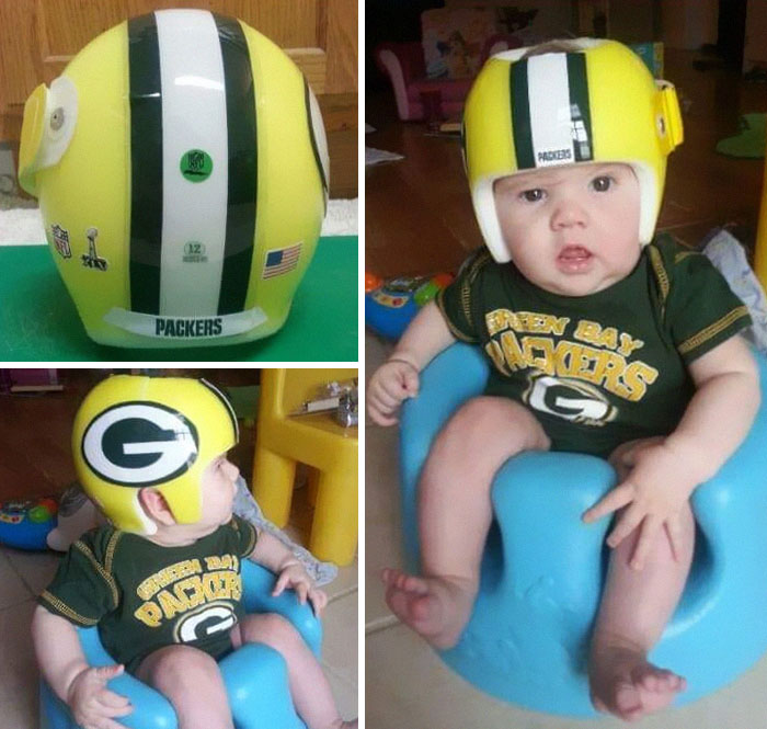 My Son Is 4 Now But He Had To Wear A Helmet Too. We Went With Our Favorite Football Team.