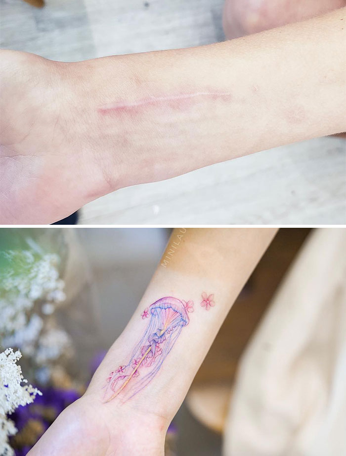 Scar-Birthmark-Tattoo-Cover-Ups