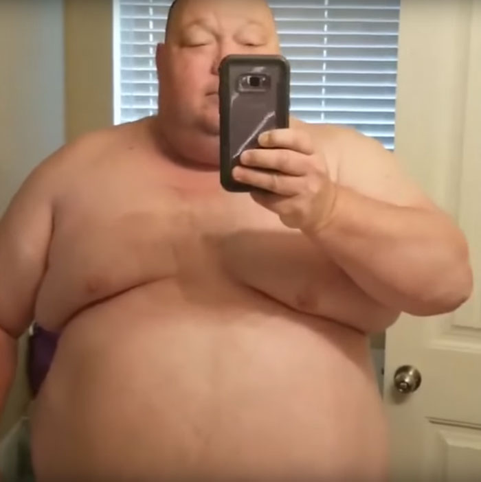 475Lbs Man Loses 198Lbs In One Year, And It's Hard To Believe It's The Same Person