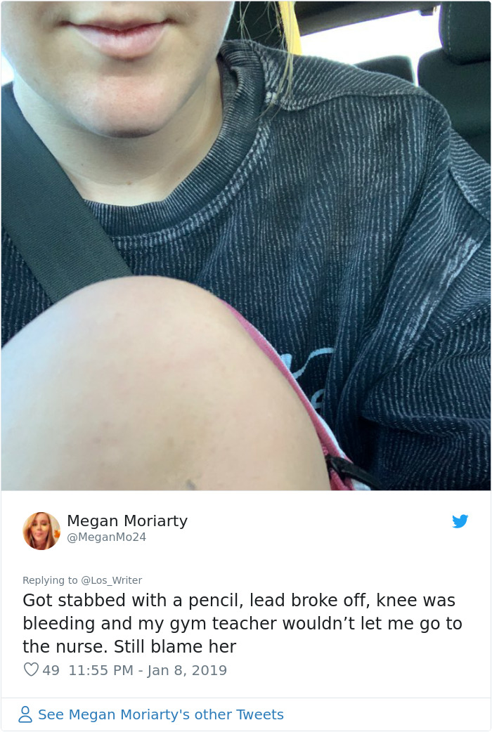 Apparently, Pencil Scars Are A Thing And There Are More People Affected Then You Would Think
