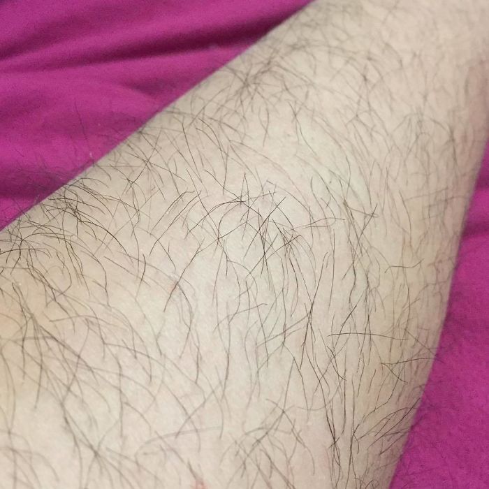 Hairy Legs