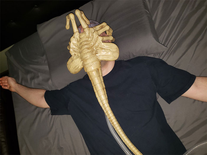 Doctors Tell This Man That He Needs To Wear A Mask To Help Him Breathe So He Turns It Into Alien Facehugger