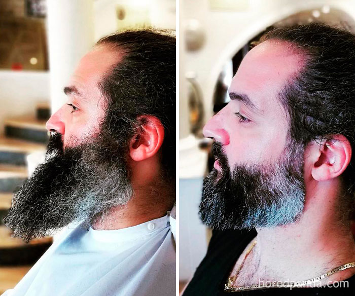 Beard Transformation